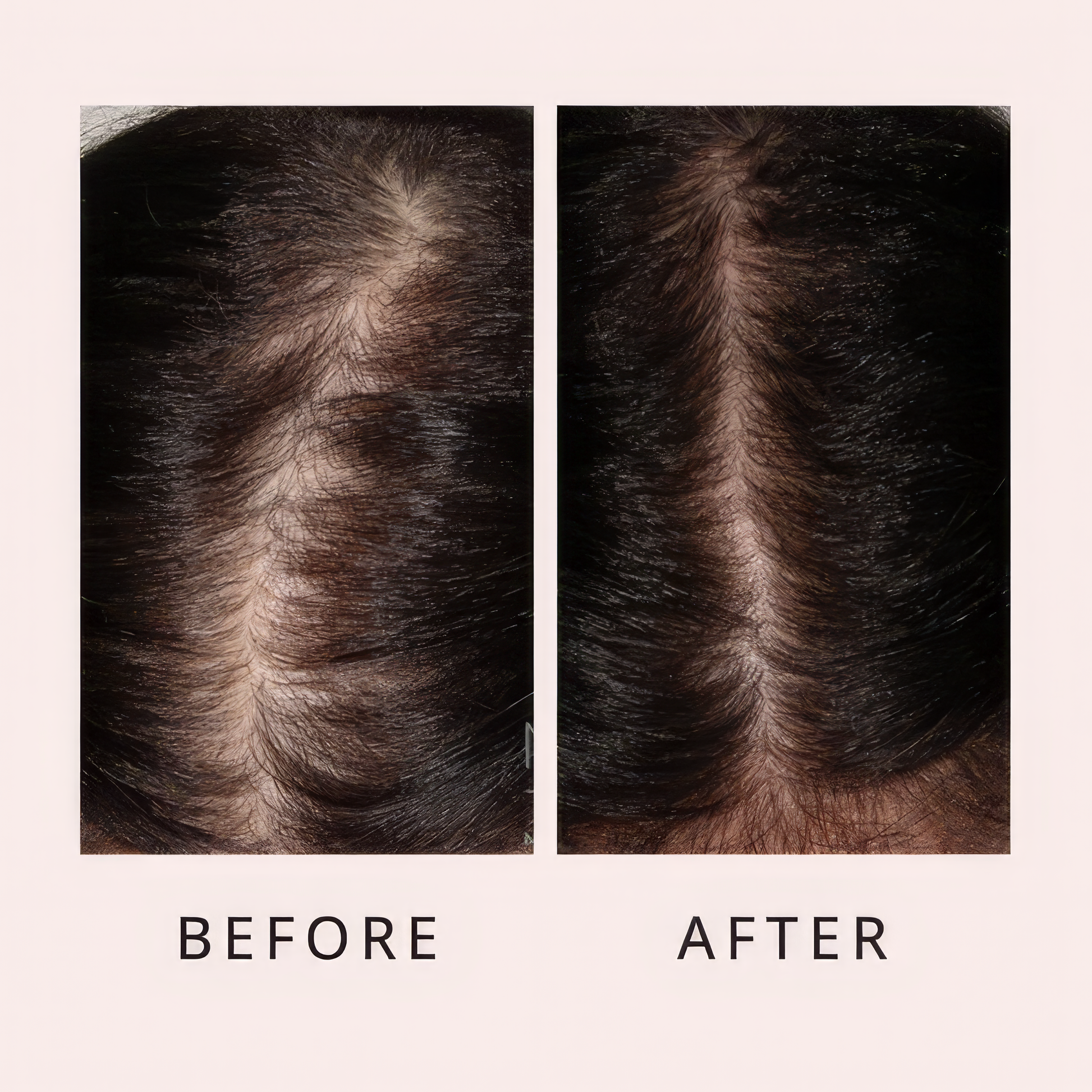 Luxe Hair Growth Serum Luxe Cosmetics US