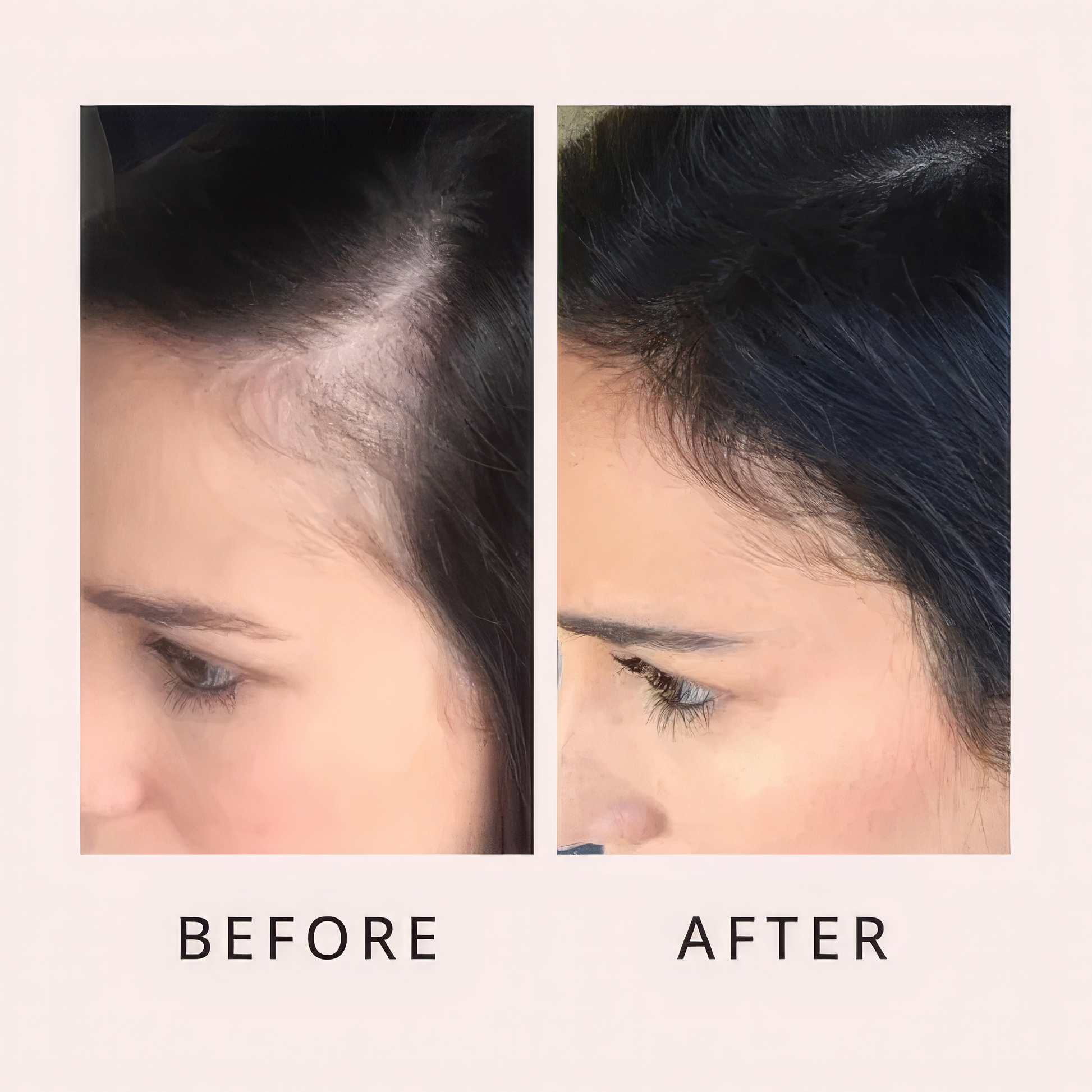 Luxe Hair Growth Serum Luxe Cosmetics US