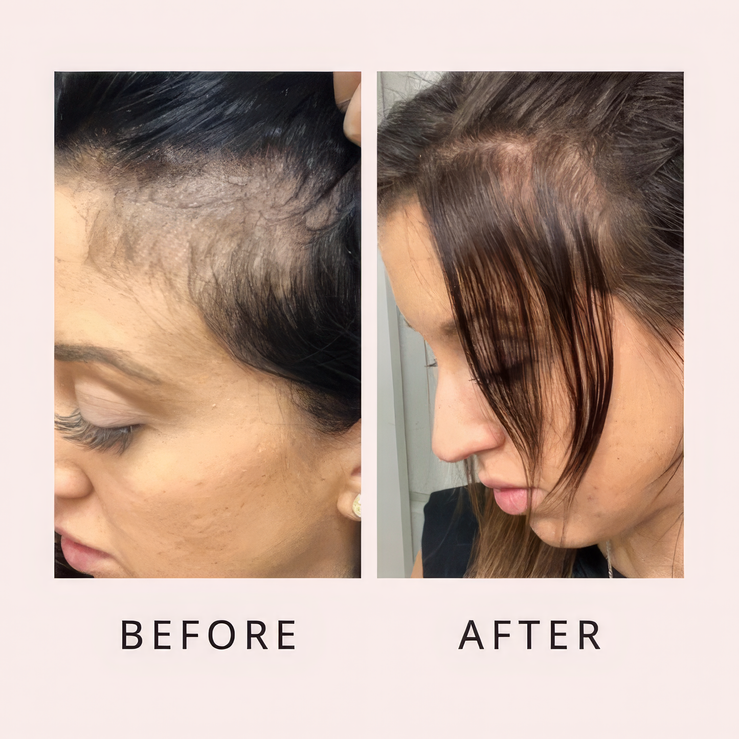 Luxe Hair Growth Serum Luxe Cosmetics US