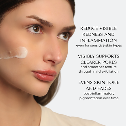 Azelaic Acid 10% My Store