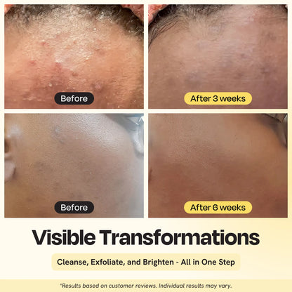 Clarifying Brightening Cleanser Gleamin