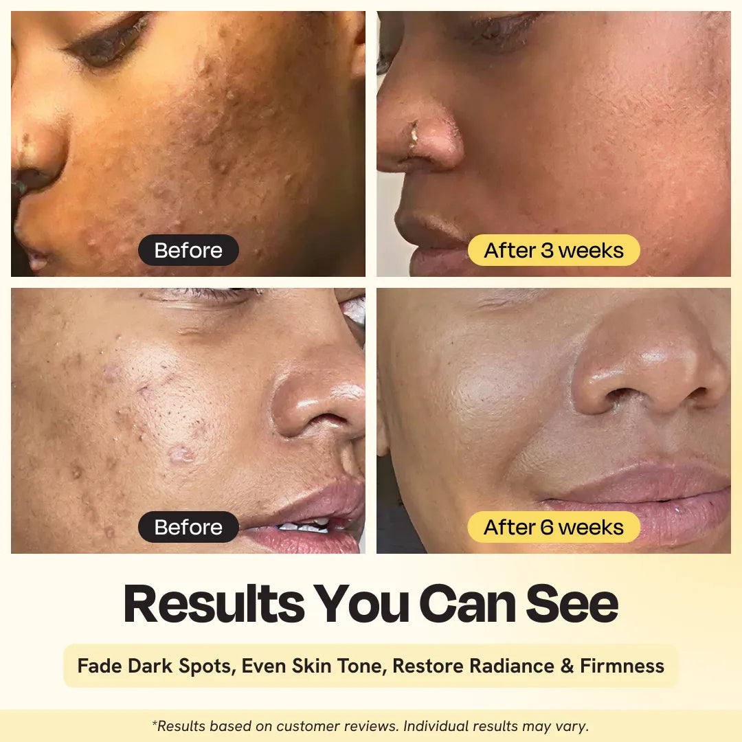 Superactive Serum Gleamin