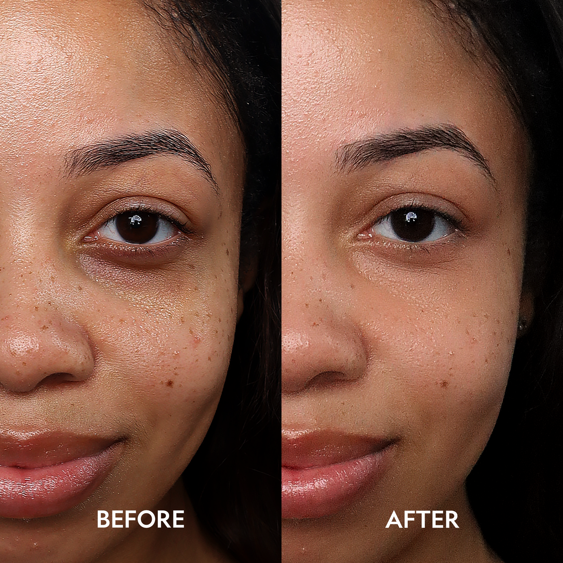 Super Bright Dark Circles Serum Peptide Corrector For Under Eye YENSA