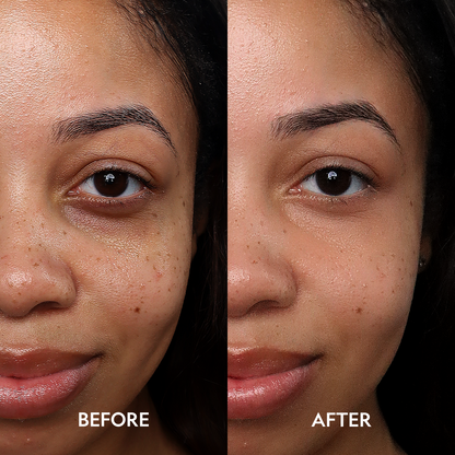 Super Bright Dark Circles Serum Peptide Corrector For Under Eye YENSA