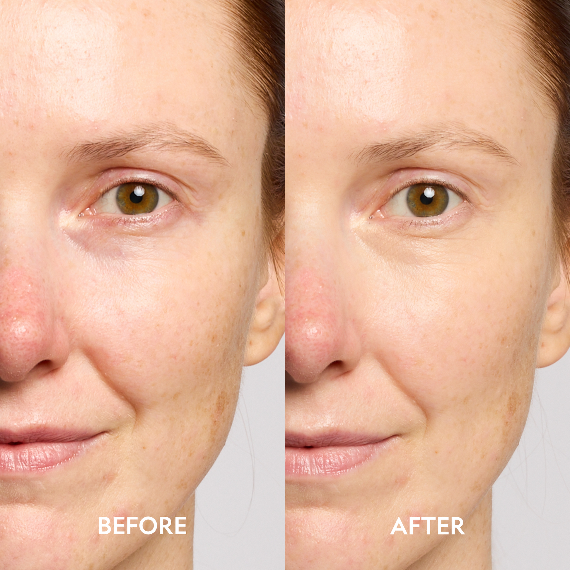 Super Bright Dark Circles Serum Peptide Corrector For Under Eye YENSA