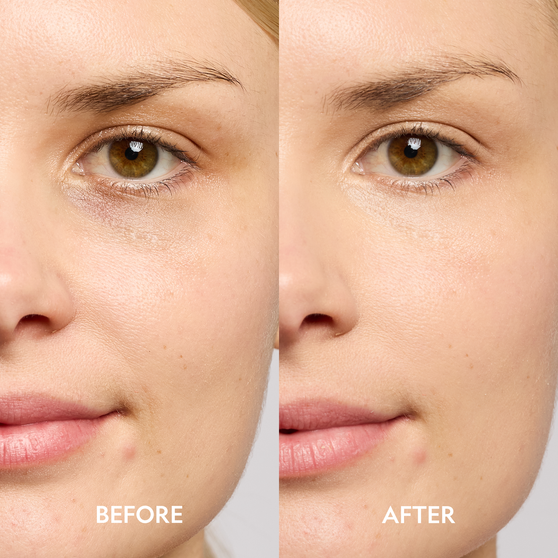 Super Bright Dark Circles Serum Peptide Corrector For Under Eye YENSA