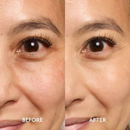 Super Bright Dark Circles Serum Peptide Corrector For Under Eye YENSA
