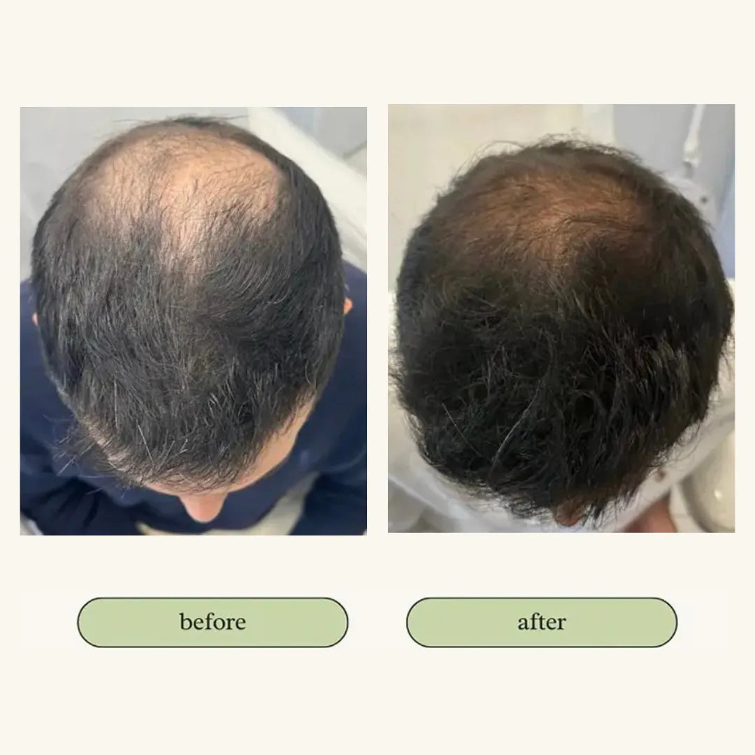 Vital Hair Trio Bundle My Store