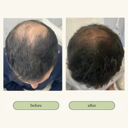 Vital Hair Trio Bundle My Store