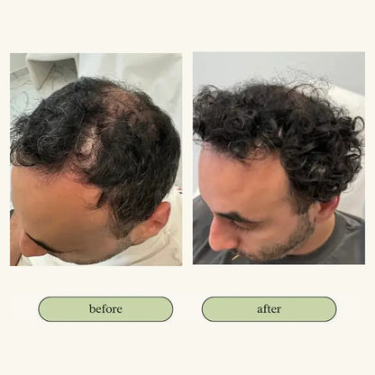 Vital Hair Trio Bundle My Store